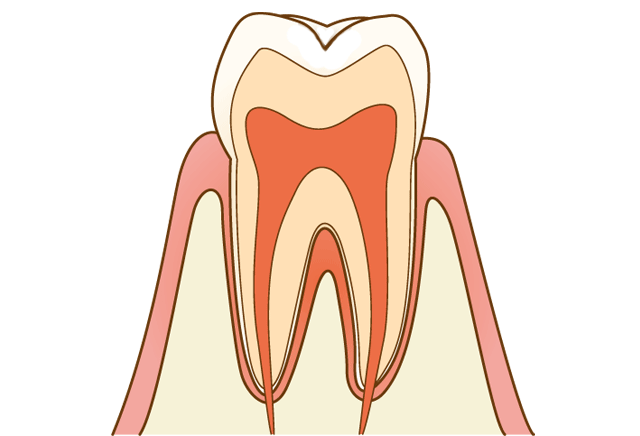 健康な状態の歯のイラスト　久喜市のいしはた歯科クリニック