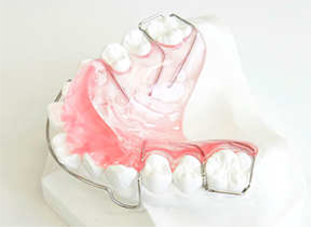 矯正の装置～斜面板～ 久喜市の歯医者いしはた歯科クリニック